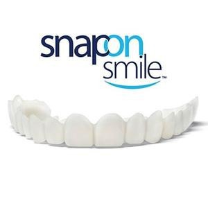 Snap-On-Smile ideiglenes foghíd