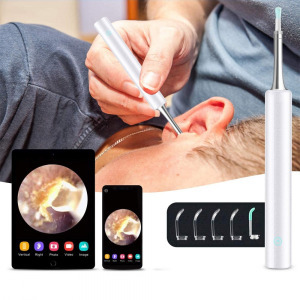 Fültisztító és endoszkóp,C3 3,9 mm- es  fekete, 6 ledes