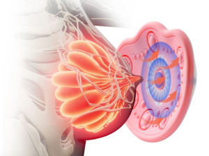 Mellfeszesítő eszköz, mell masszírozó