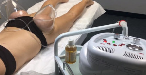 Vákuumterápiás anticellulitisz készülék